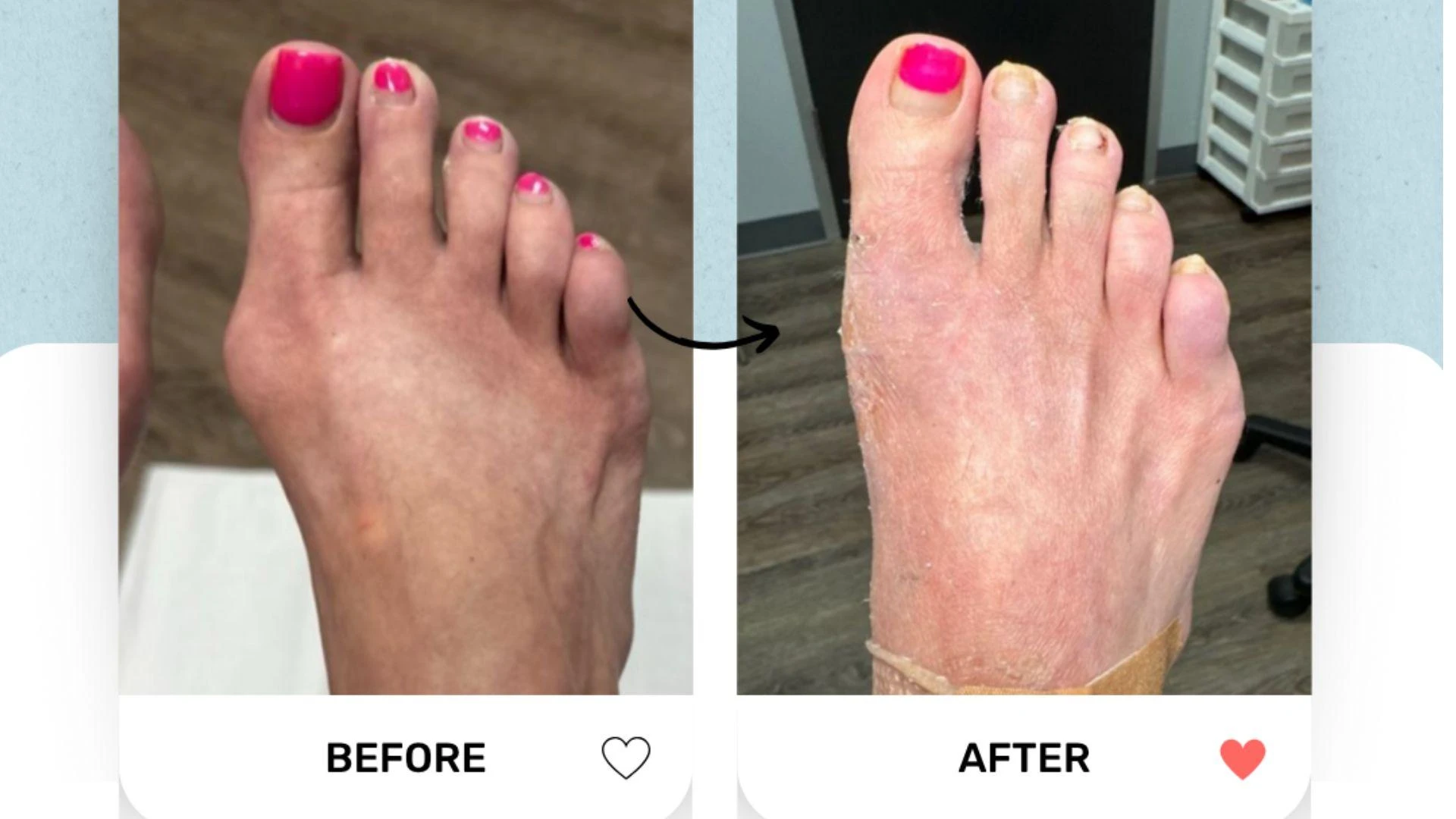 Foot Surgery Specialist Houston: What Patients Should Know