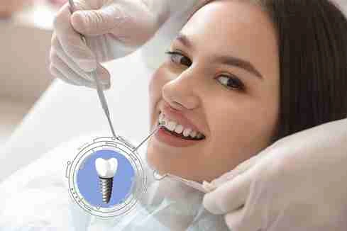 From Ceramic to Metal: A Guide to Modern Dental Crowns Options