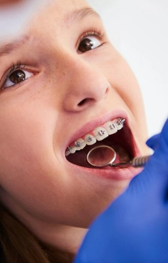 Expert Orthodontist Bankstown for Confident Smiles