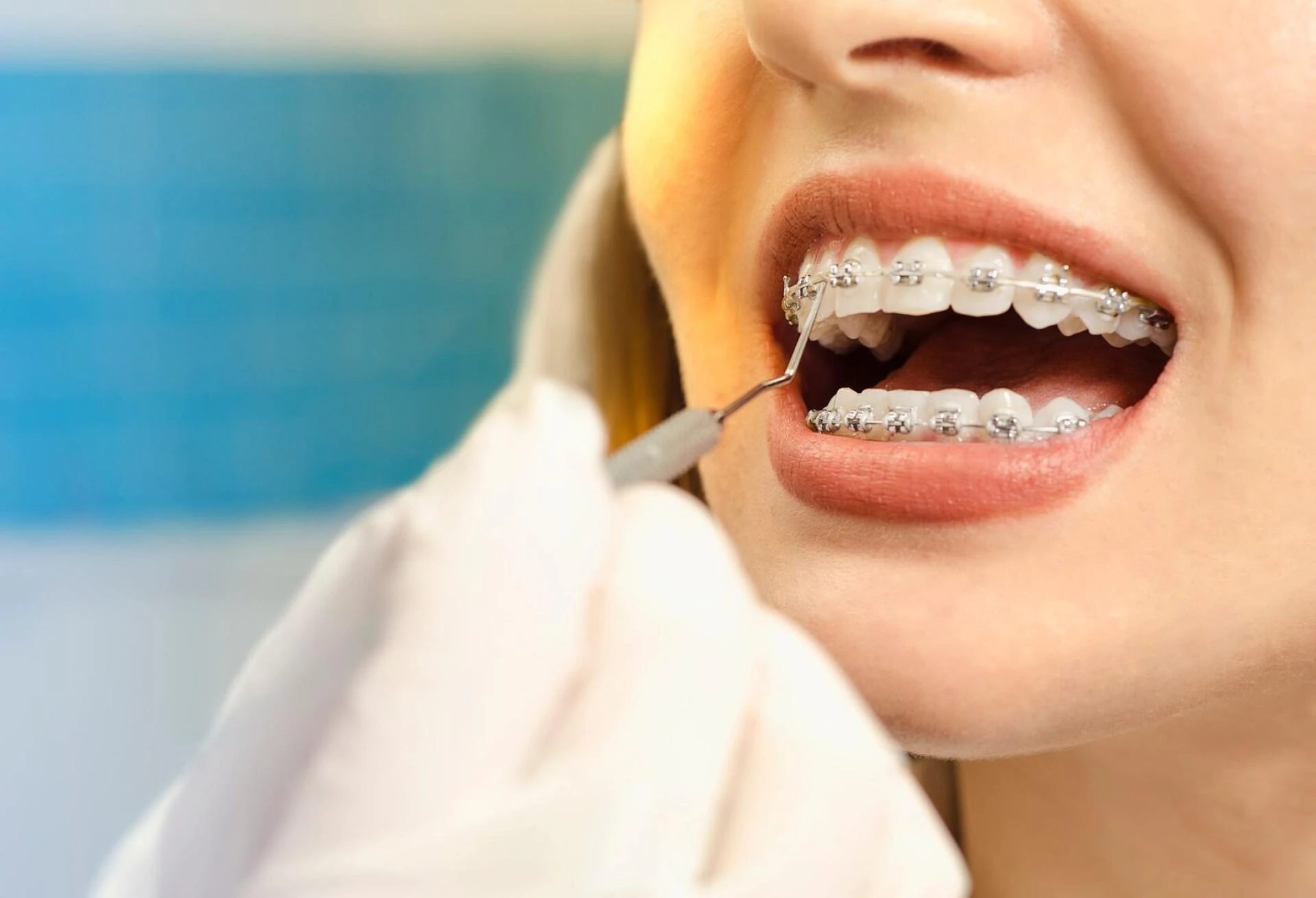 Orthodontic Treatment in Pune | Best Orthodontist for Braces & Aligners