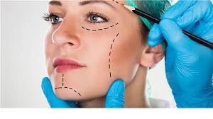 Beverly Hills Facial Plastic Surgery: A Complete Guide to Face, Nose, and Neck Procedures