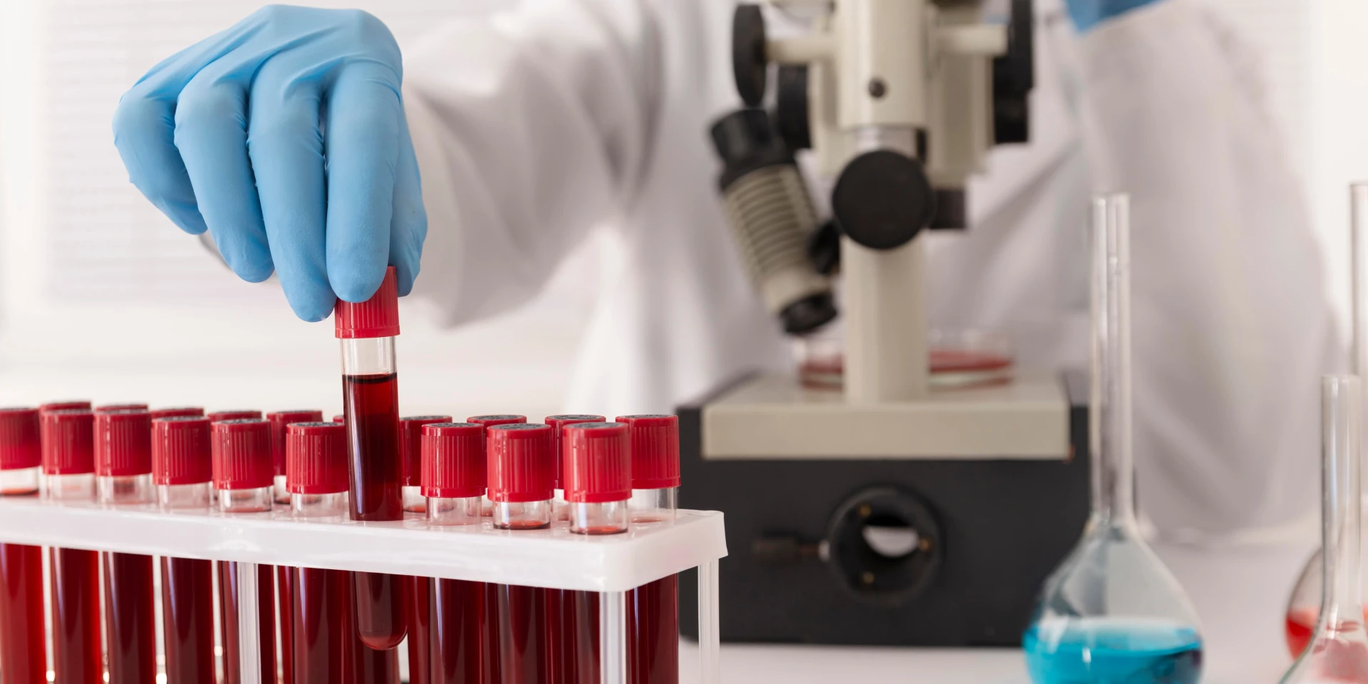 Need a Blood Test? Here are the 5 Best Labs in Noida