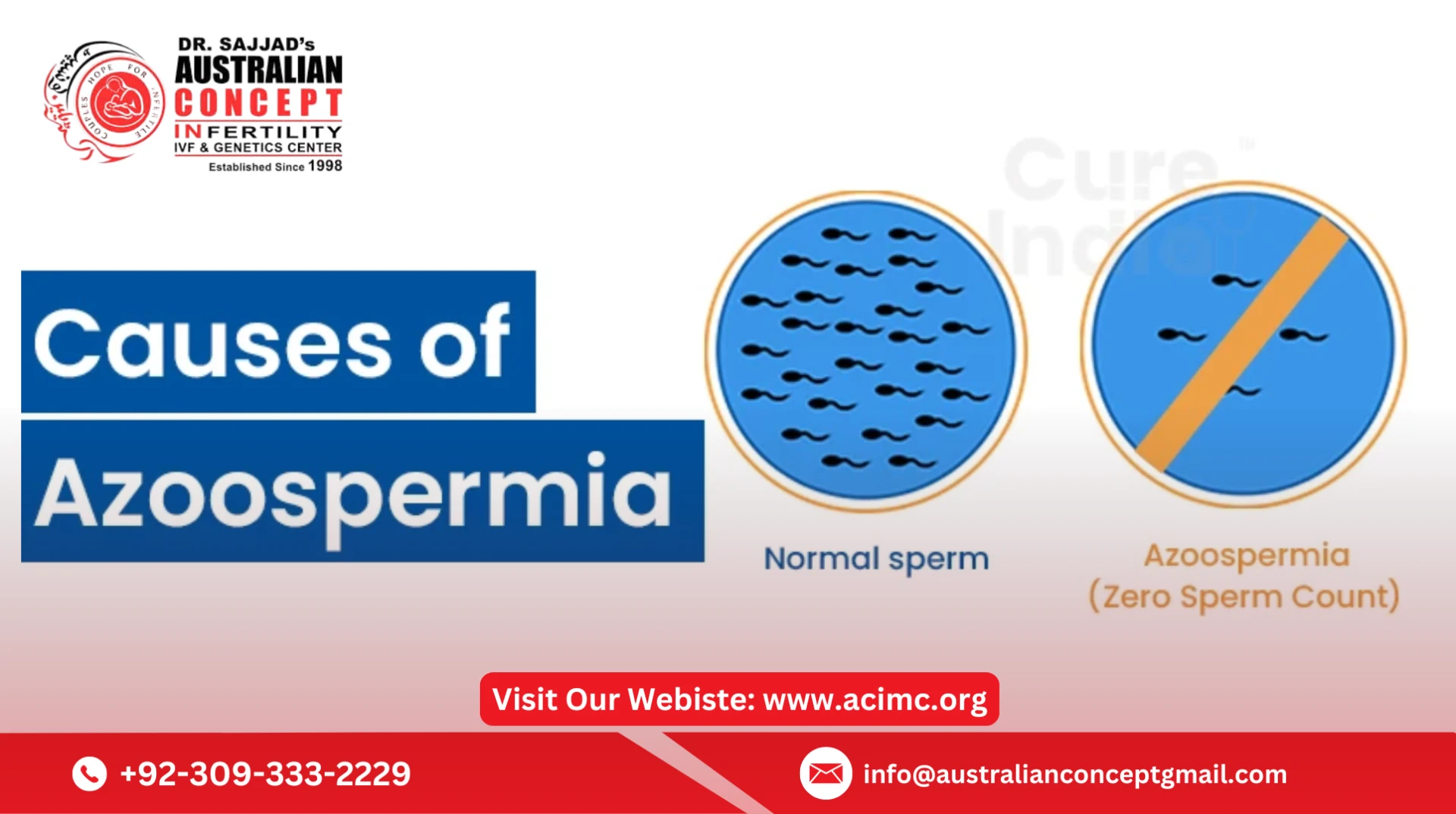 How is obstructive azoospermia treatment different