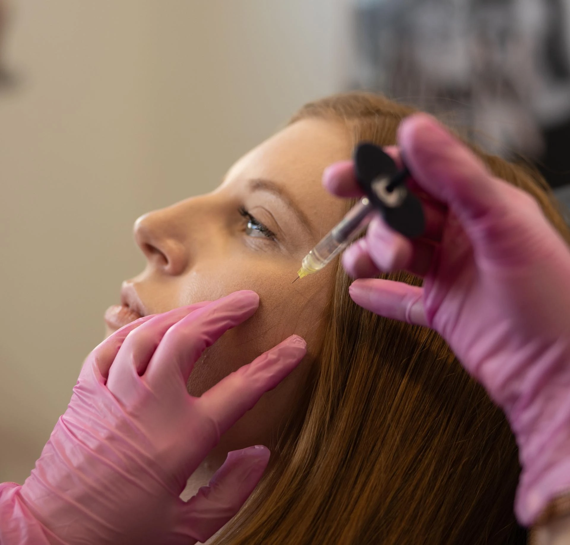 Cheek Fillers: Enhance Facial Volume and Restore Youthful Contours Naturally