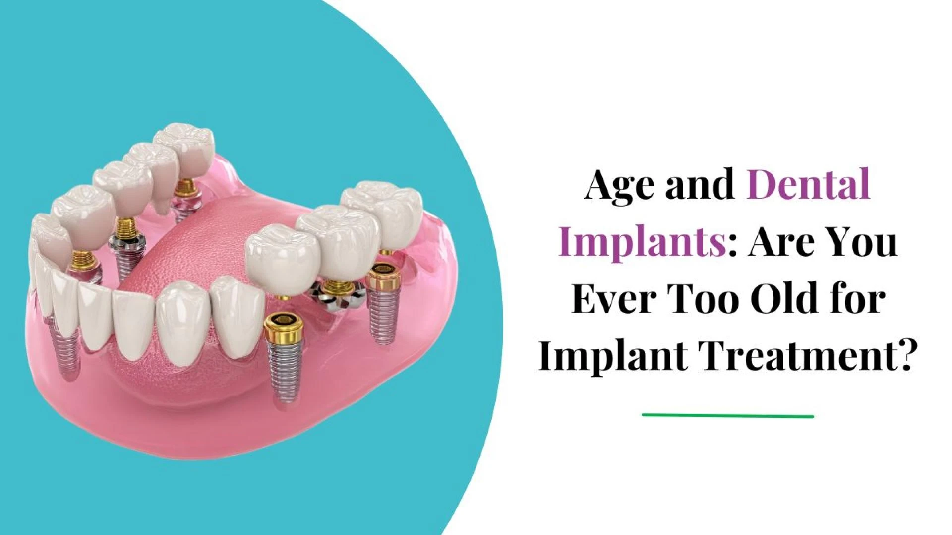 Age and Dental Implants: Are You Ever Too Old for Implant Treatment?