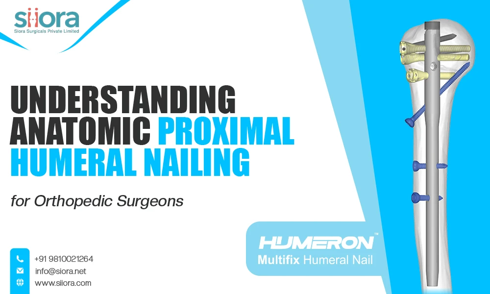 Understanding Anatomic Proximal Humeral Nailing for Orthopedic Surgeons