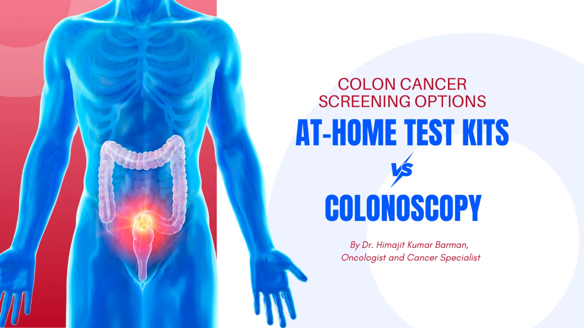 Colon Cancer Screening Options: At-Home Test Kits vs Colonoscopy