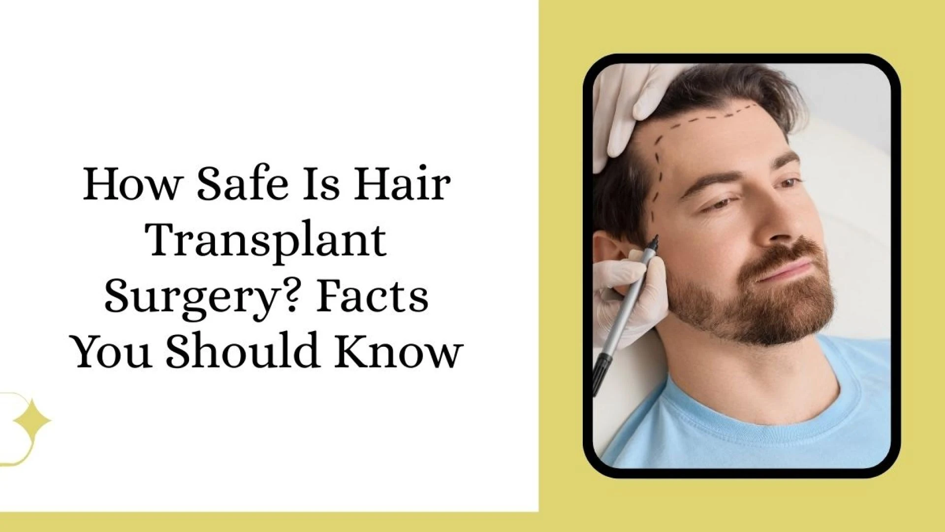How Safe Is Hair Transplant Surgery? Facts You Should Know