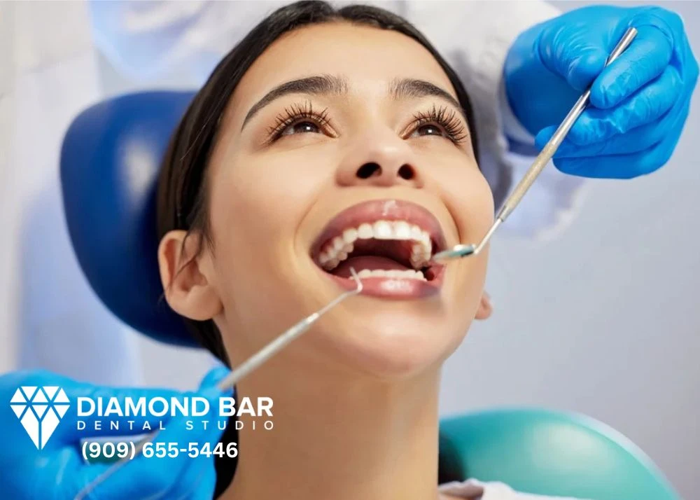 Dental Implants Diamond Bar CA | Dentists Dentures Near Me