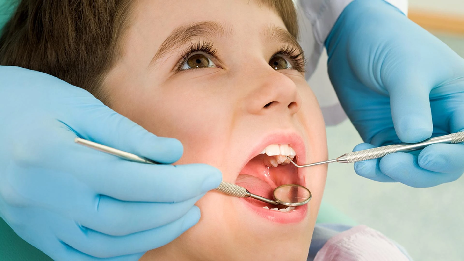 Exploring Root Canal Treatment for Kids: Why Is It Necessary?