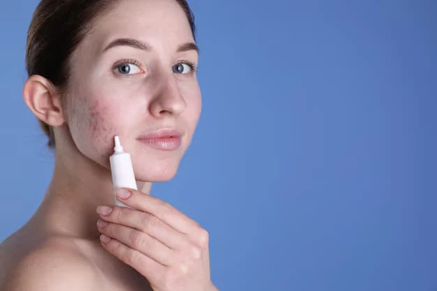 Acne Marks Removal Cream to Fade Stubborn Scars