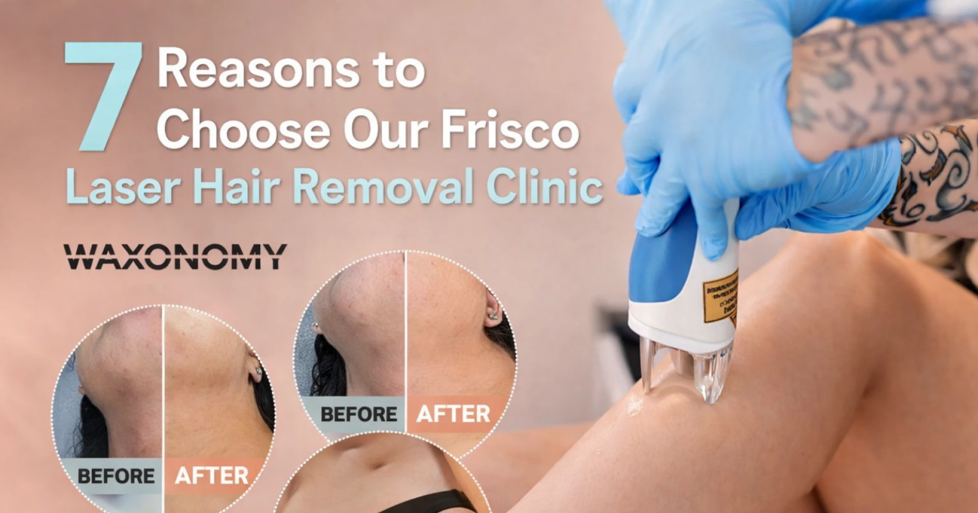 8 Reasons Laser Hair Removal in Frisco Is the Ultimate Glow-Up