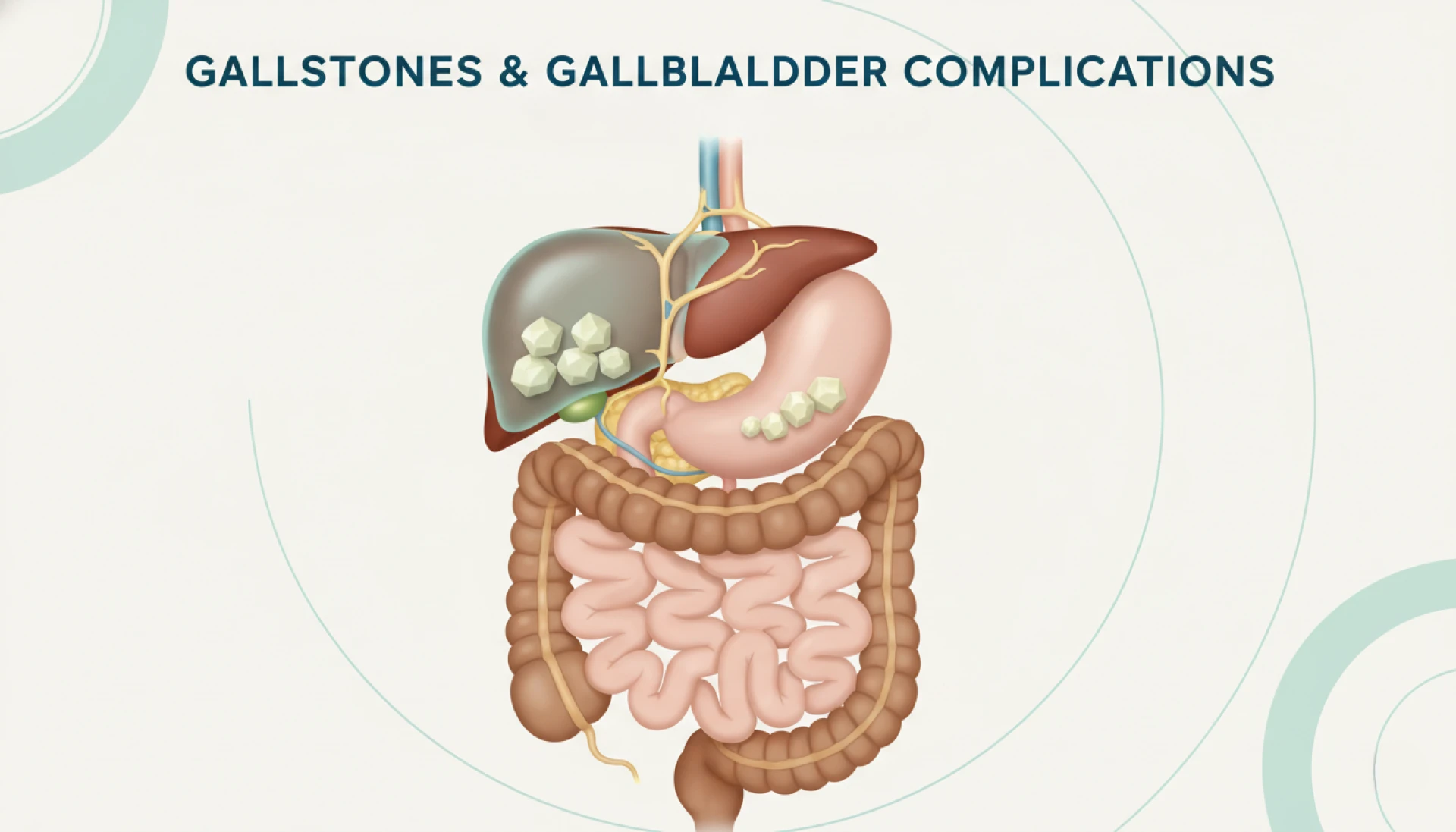 Complications Due to Gall Stones: When to Consult a Gallbladder Specialist in Ahmedabad?