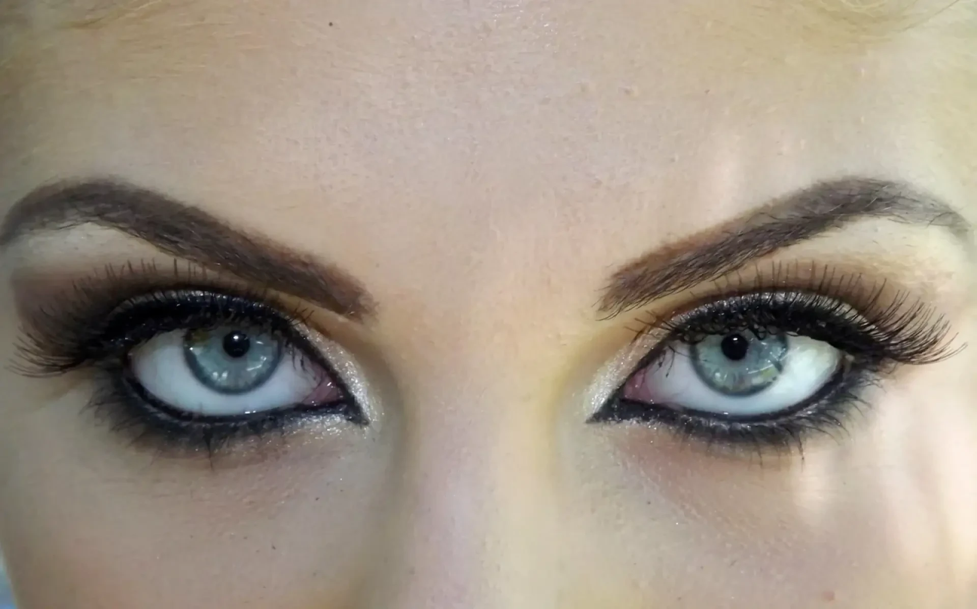 Why Choose Eyebrow Transplant in Turkey for Natural Brows
