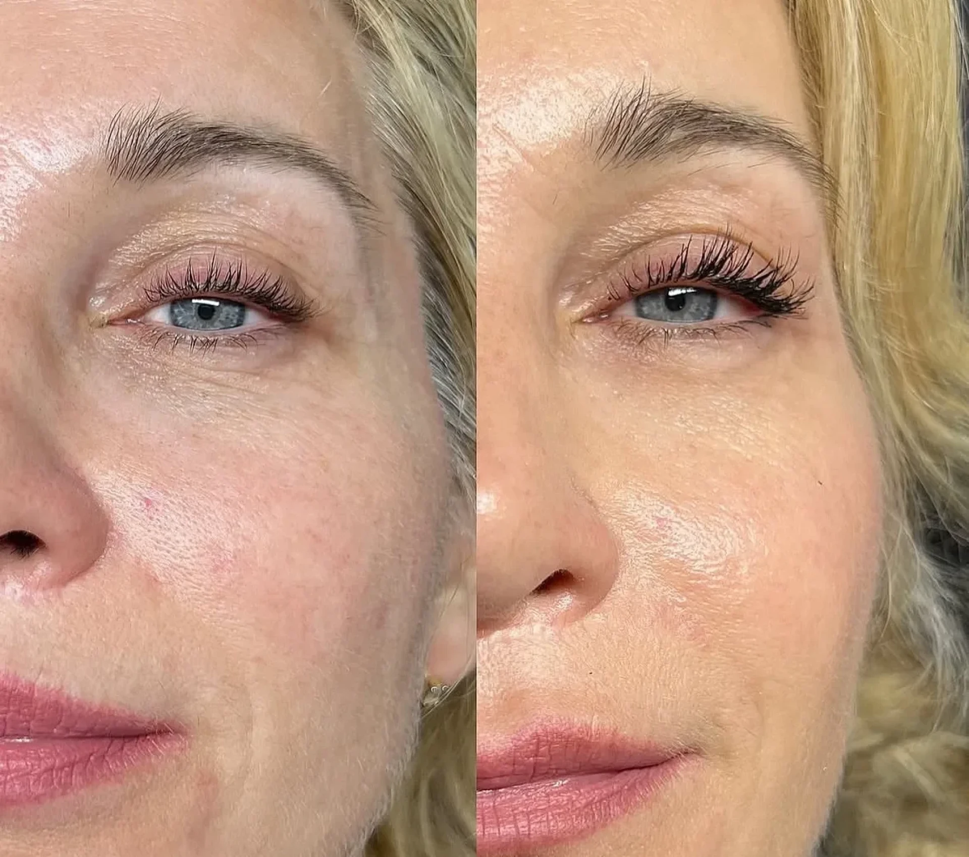 Eyebrow Serum Malta – Fuller, Healthier Brows with Venus Distribution Malta