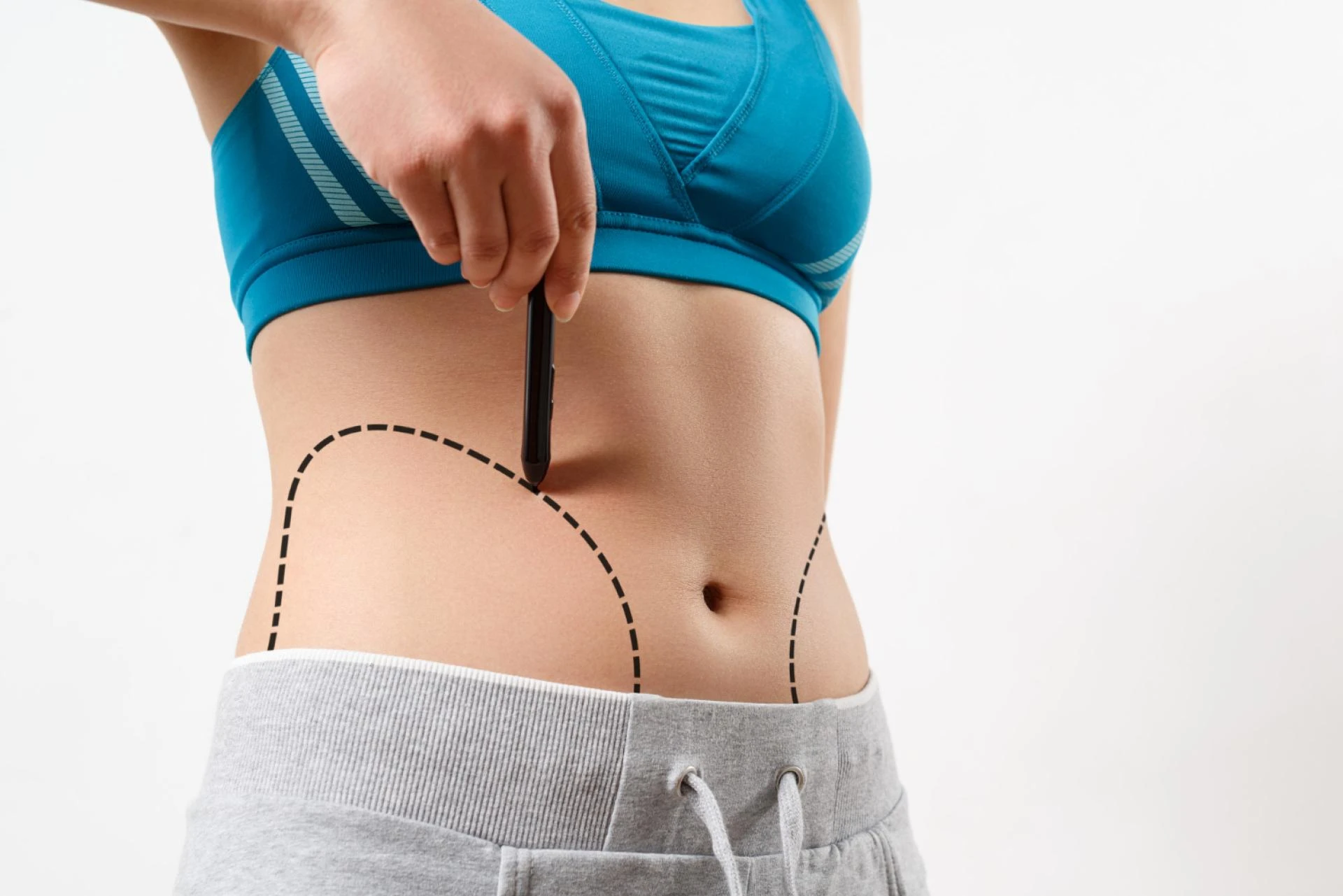 VASER Liposuction Surgery in Dubai: High-Definition Results with Advanced Technology
