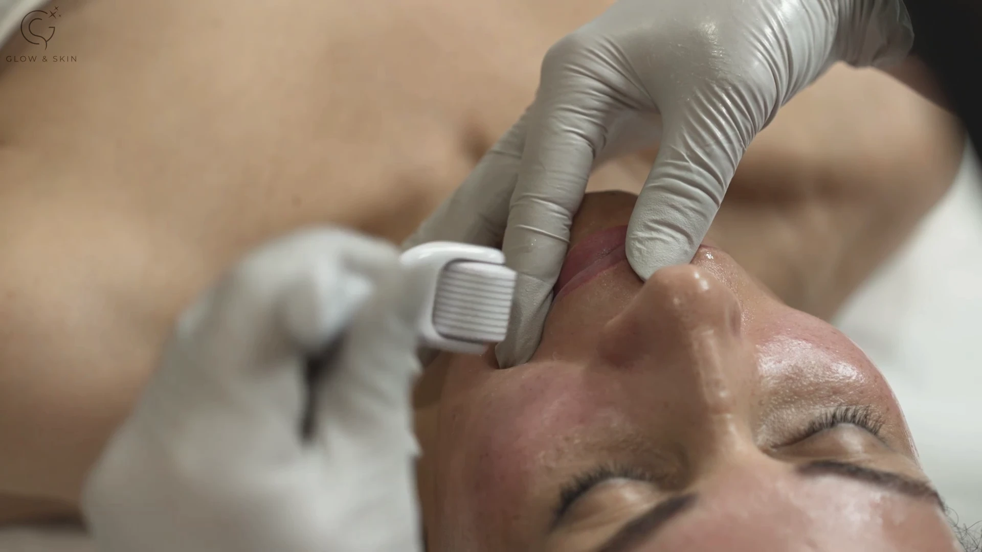 A Professional’s Guide to Choosing the Right Microneedling Kit