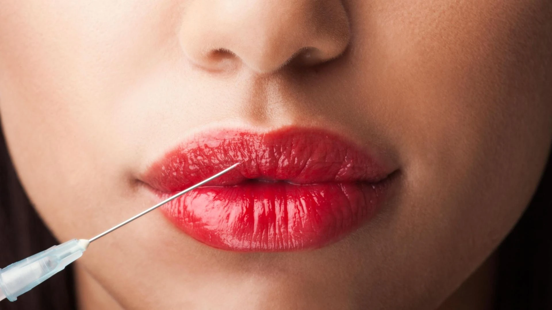 How do I prepare for my first lip filler session in Dubai?