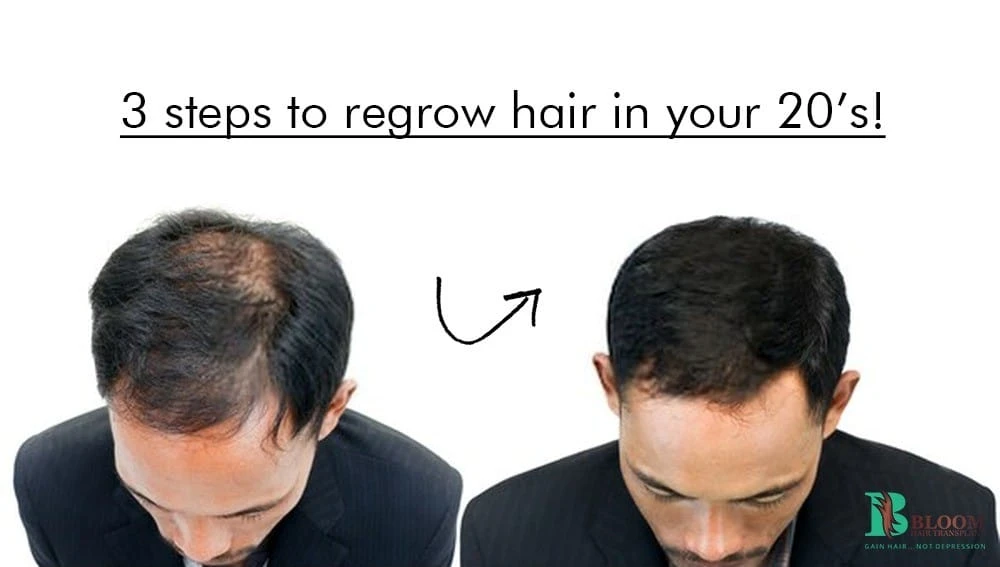 How to give second chance to your hair?