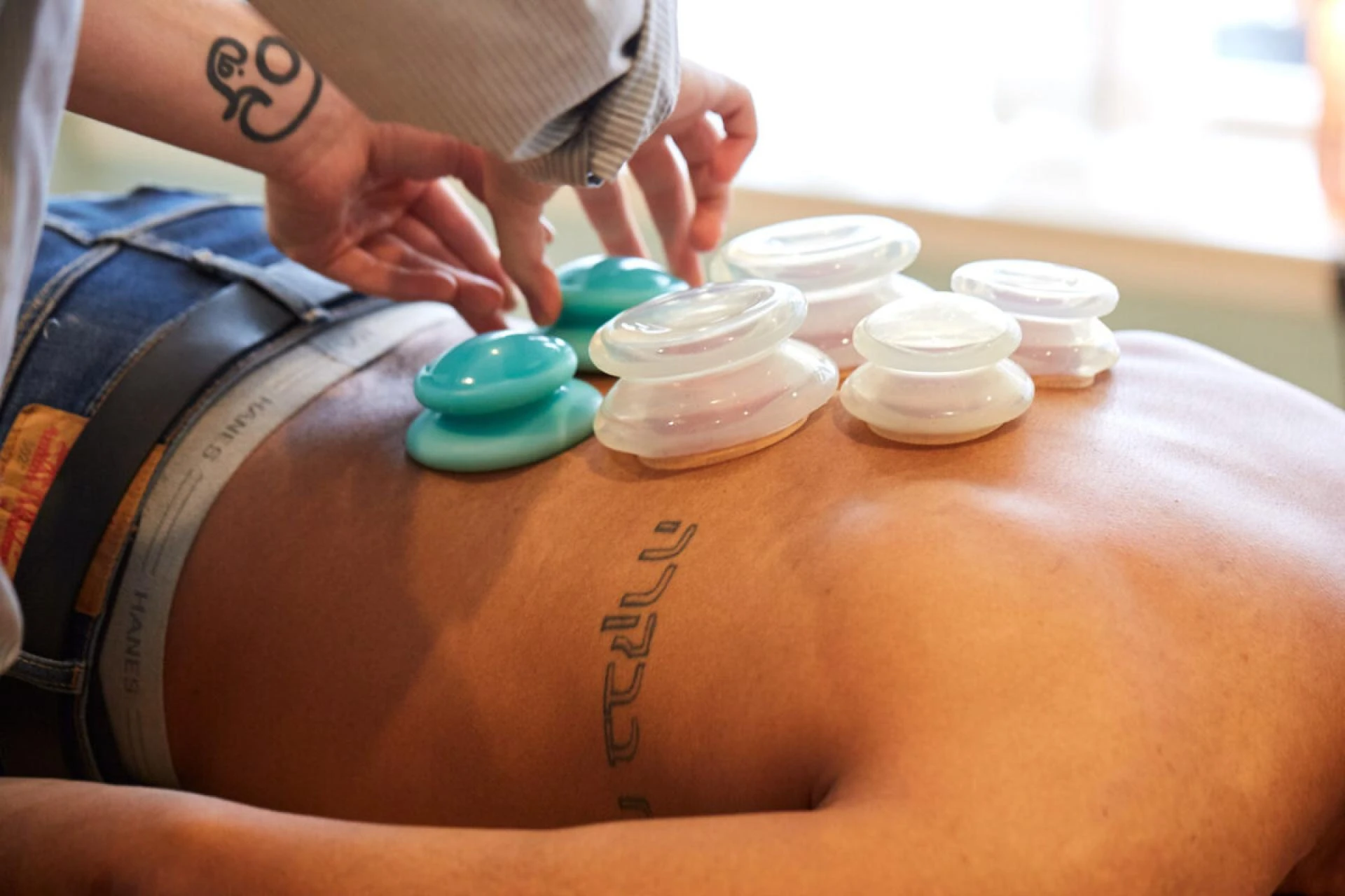 Experience Safe and Effective Cupping Therapy Philadelphia