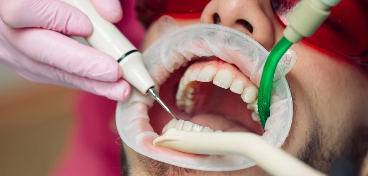 Dental Tourism in Mumbai: Affordable Solutions for International Patients