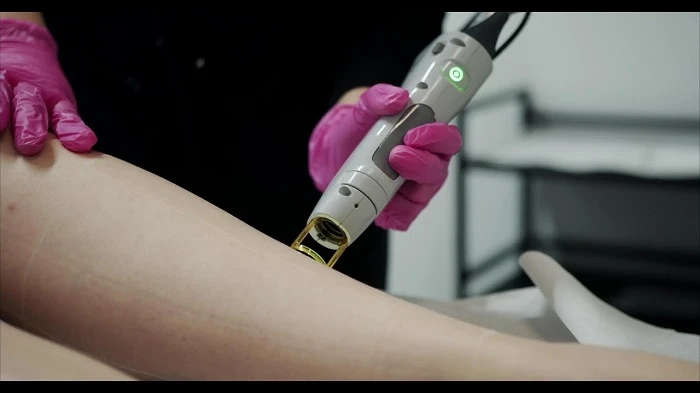 Laser Hair Removal Guide With Top Tips And Expert Knowledge