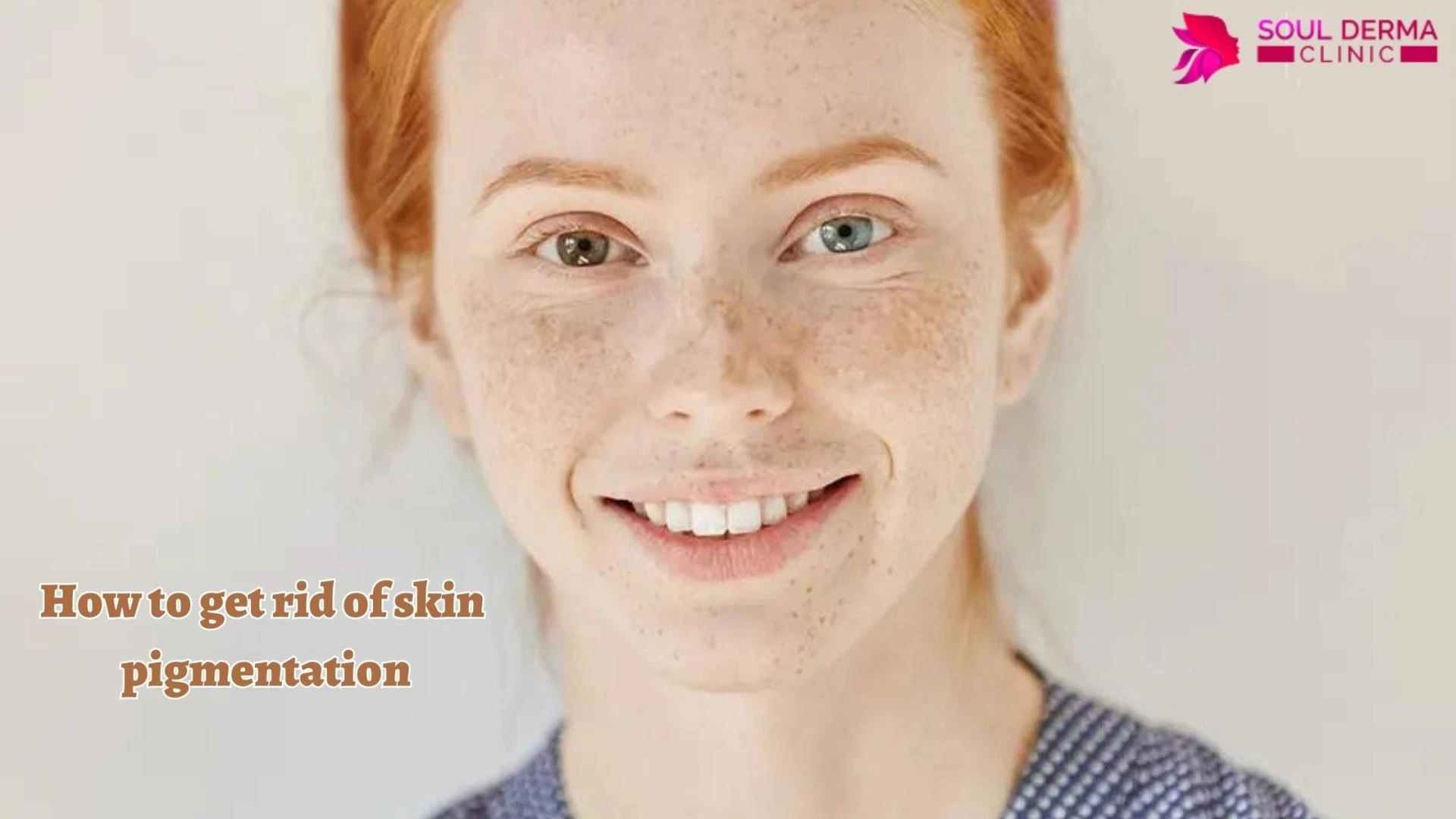 How to get rid of skin pigmentation