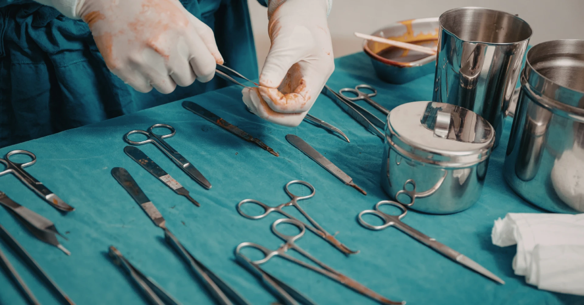 What You Need to Know About Varicose Veins and How to Treat Them