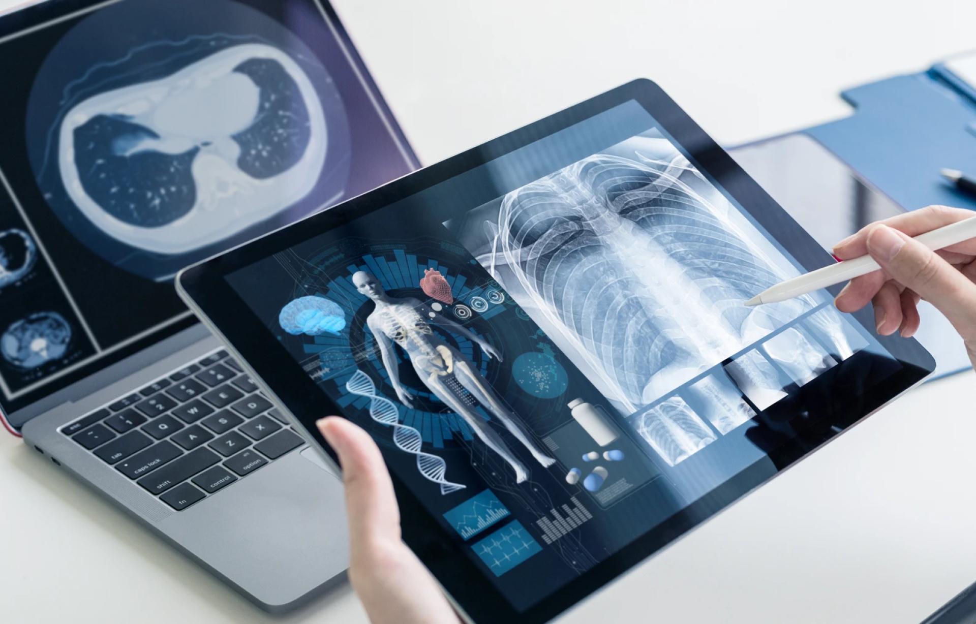 How Remote Teleradiology Is Transforming Hospital Imaging Workflows
