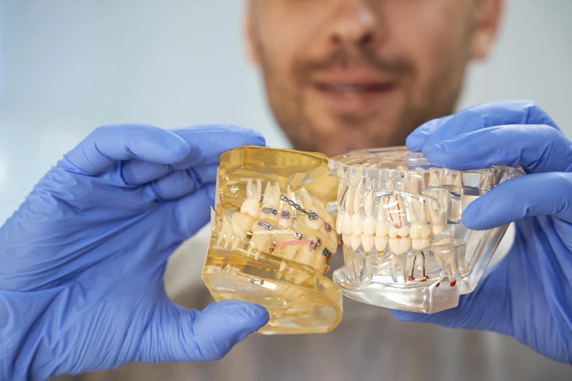 Thinking About Dental Implants in 2026? Why Starting Early Matters