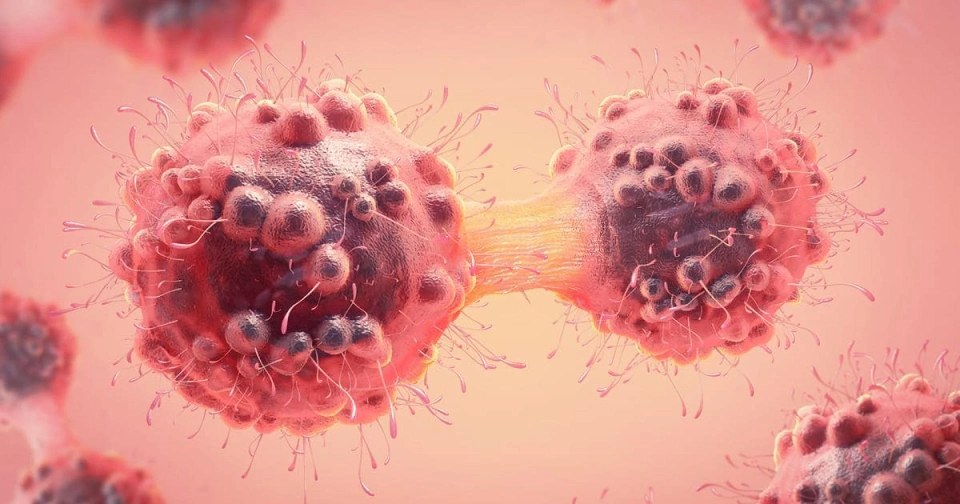 Early Diagnosis and Advanced Cancer Management at Metro Hospital