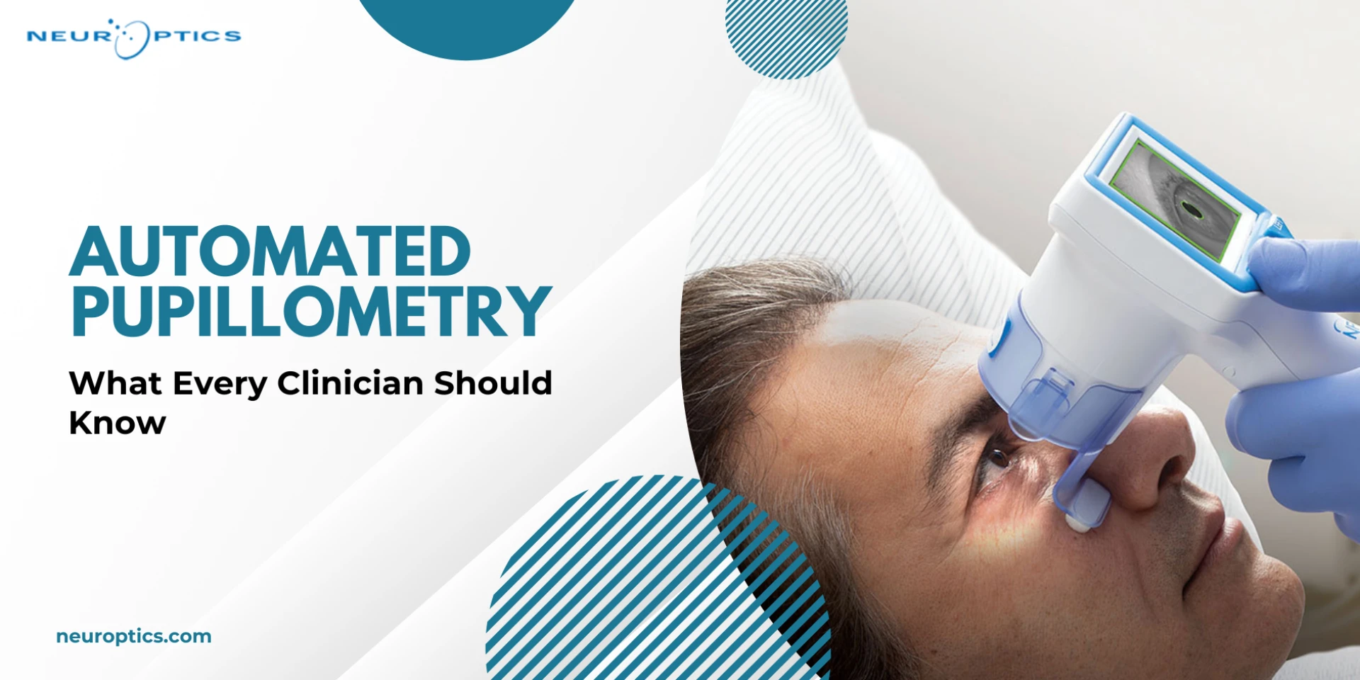 Automated Pupillometry: What Every Clinician Should Know