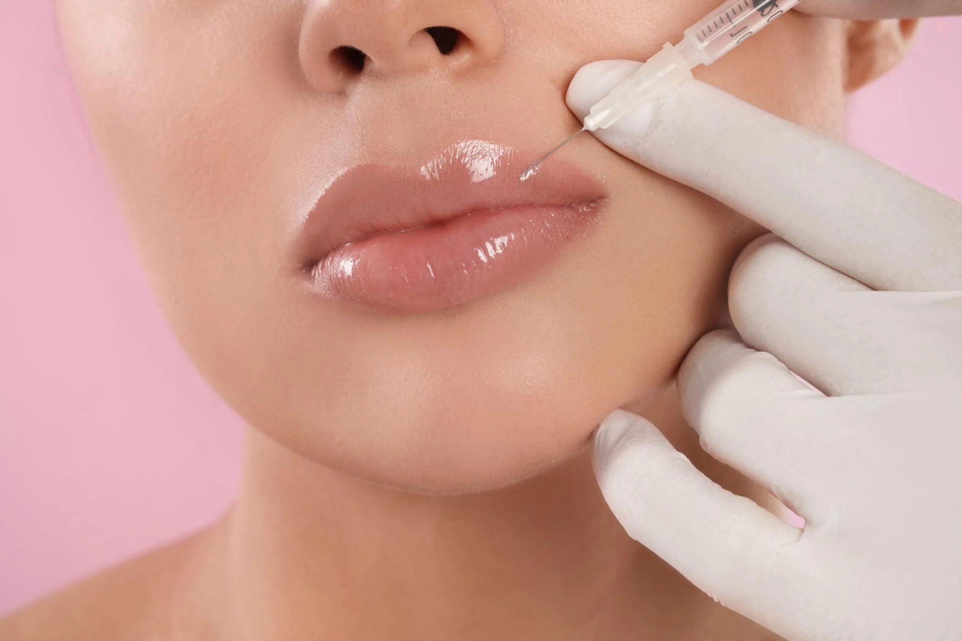 How Do I Prepare for a Lip Filler Appointment?