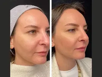 Best Aesthetic Clinics in Dubai for Safe Injectable Mesotherapy