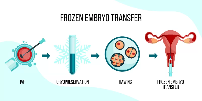 What Is Frozen Embryo Transfer Treatment?