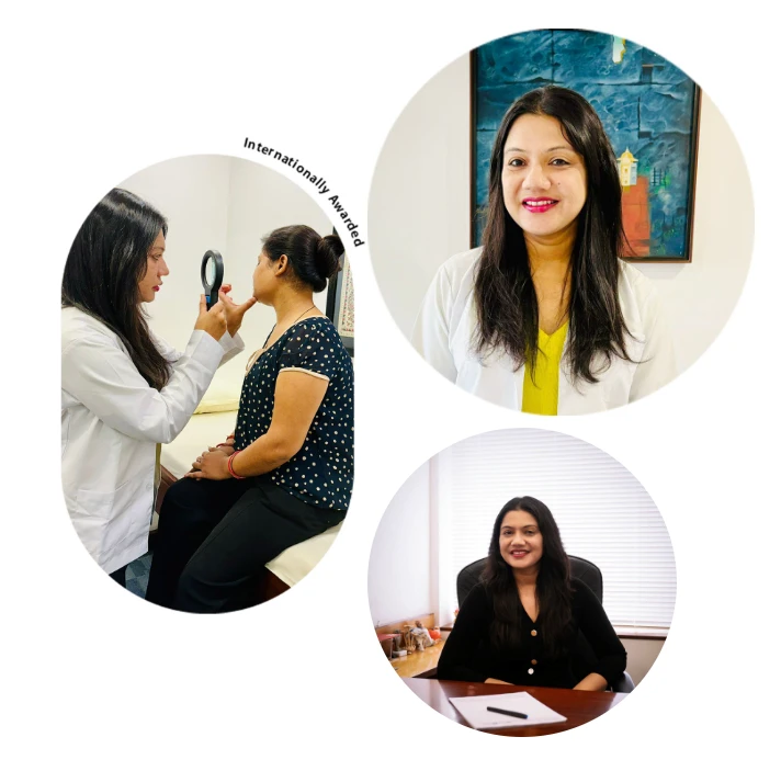 PRP Hair Treatment in Gurgaon and Psoriasis Treatment in Gurgaon: A Smarter Approach to Hair and Skin Health