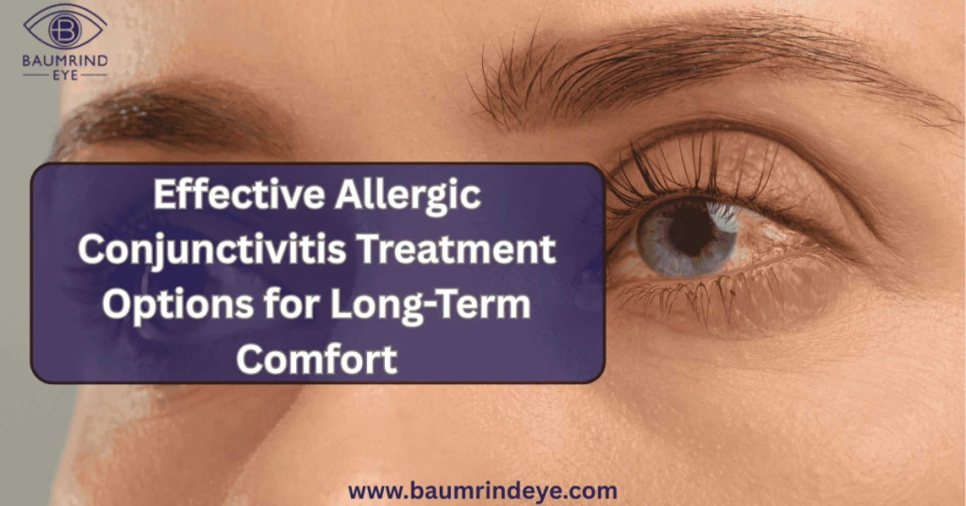 How Eye Doctors Diagnose Allergic vs. Infectious Conjunctivitis