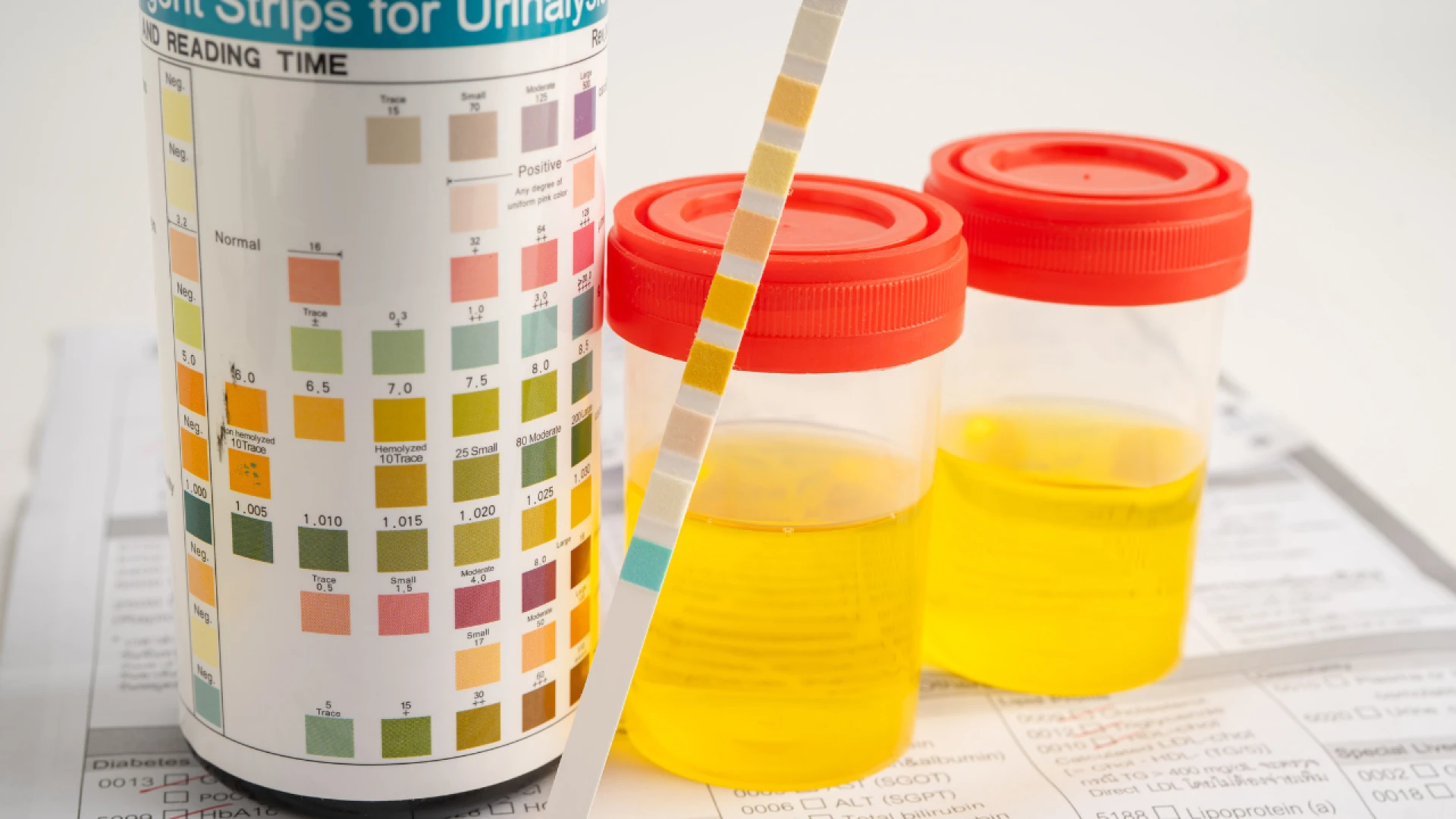 7 Essential Facts About Urine Drug Test Accuracy – Make An Appointment