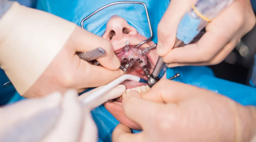 Advanced Oral & Maxillofacial Surgery in Aurangabad for Complete Facial Care
