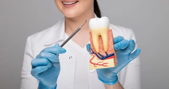 5 Signs You Might Need a Root Canal Treatment