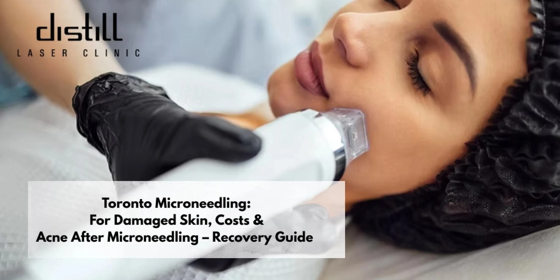 Toronto Microneedling:  For Damaged Skin, Costs & Acne After Microneedling – Recovery Guide