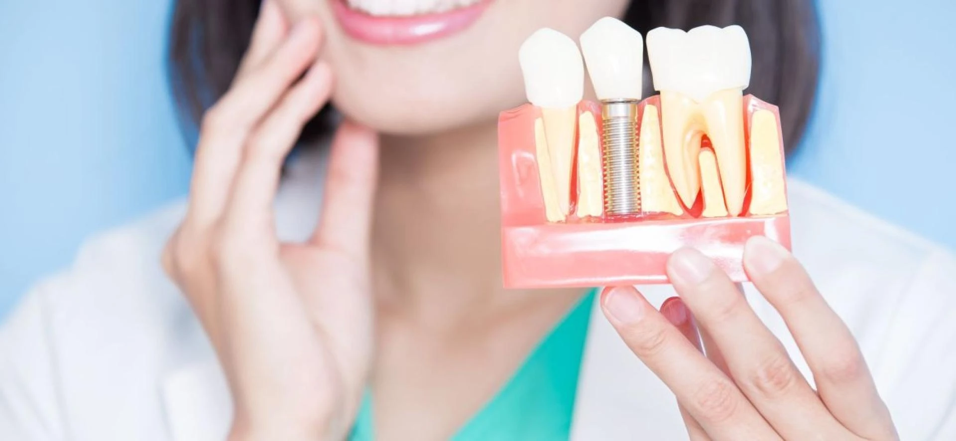 How Long Does Dental Implant Treatment Last? Lifespan & Care Tips