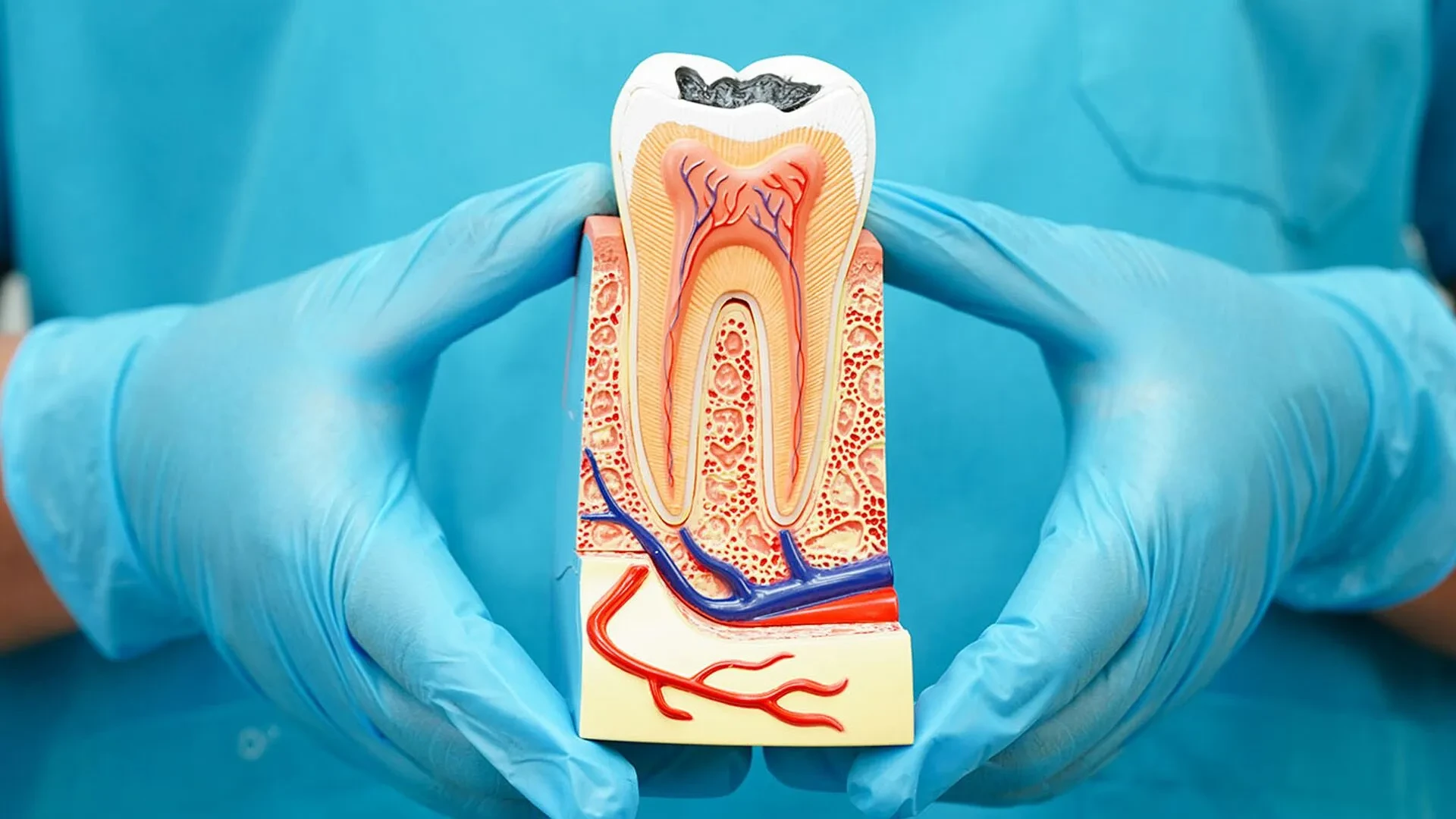 The Complete Guide to Root Canal Treatment and Recovery