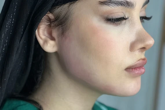 Clear Skin Solutions: Los Angeles and Beach City Acne Treatment