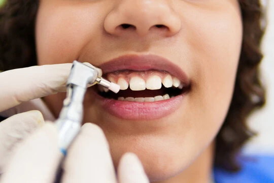 The Importance Of Regular Teeth Cleaning For Oral Health