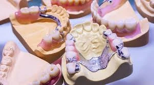 What to Know Before Getting Dentures in Henderson
