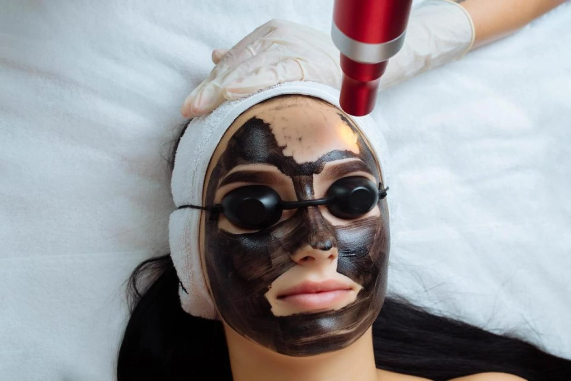 Radiant Skin in Minutes: A Step-by-Step Guide to the Carbon Peel Treatment