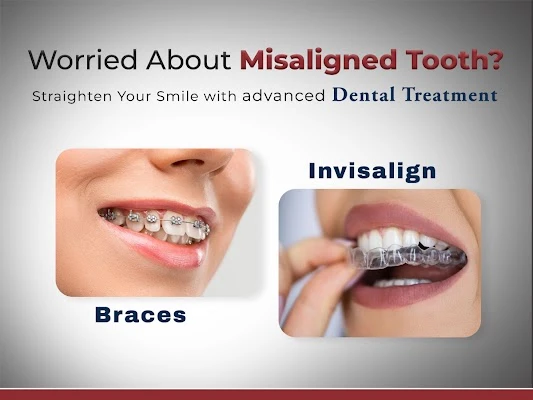 Smile Correction Treatment in Dilsukhnagar with FMS Dental