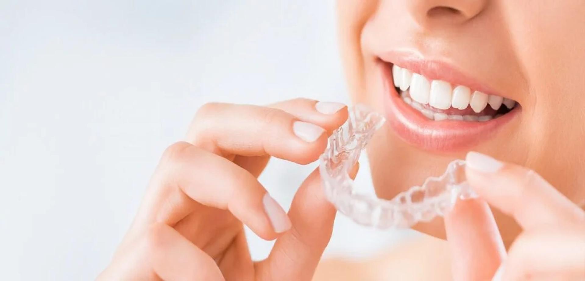 Top Questions to Ask Your Invisalign Specialist Before Starting Treatment