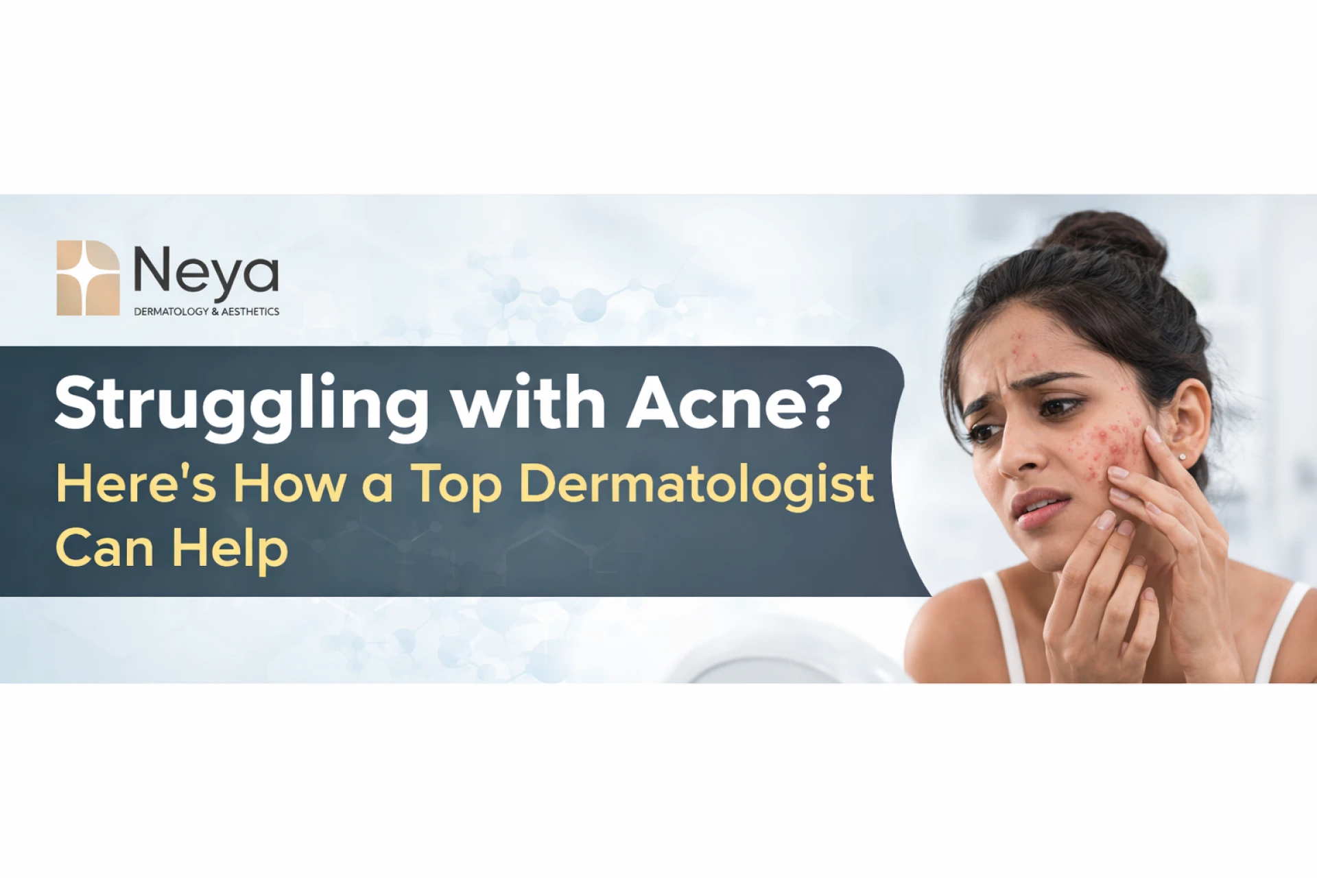 Struggling with Acne? Here’s How a Top Dermatologist Can Help